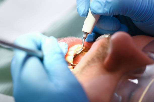 Best After-Hours Emergency Dentist in Drew, MS