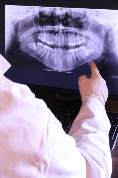 Best Emergency Broken Tooth Repair in Drew, MS
